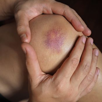 Physical Therapy Near Brentwood
